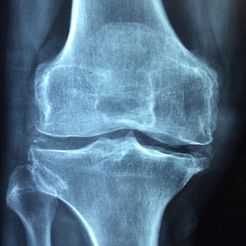 Bone Care